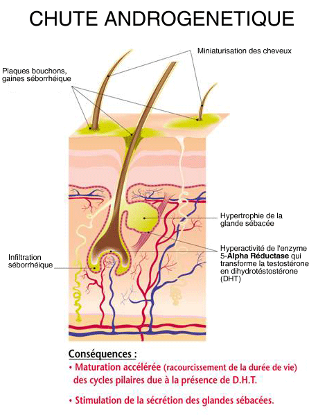 Les recettes des masques pour les cheveux de la démangeaison